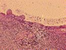 http://path.upmc.edu/cases/case2/images/micro1.gif