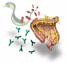 T. cruzi and our autoimmune response