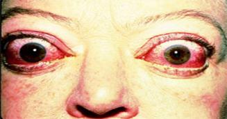 http://www.mo-media.com/pathology/grapic.jpg