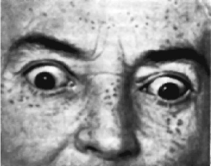 149