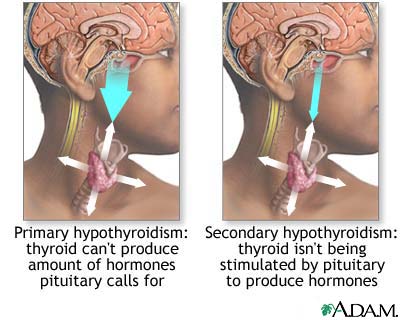 http://www.nlm.nih.gov/medlineplus/ency/images/ency/fullsize/17126.jpg