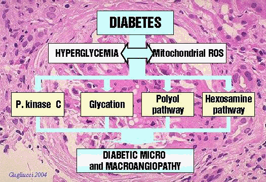 http://www2.warwick.ac.uk/fac/med/research/csri/proteindamage/physiology/diabetes/imars20figure201.gif