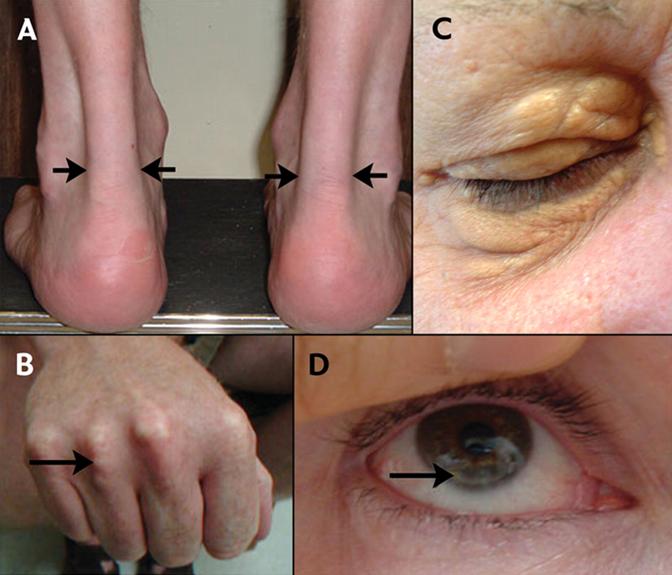http://www.cmaj.ca/content/vol174/issue8/images/large/26ff1.jpeg