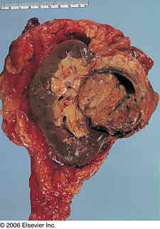 http://www.pathconsultddx.com/images/S1559867506704880/gr8-sml.jpg
