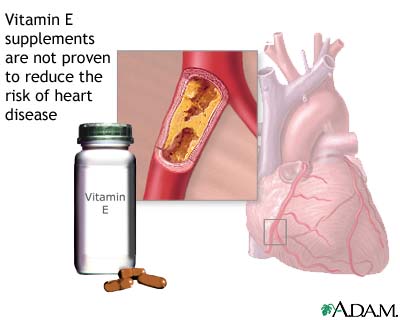 Vitamin E and Heart Disease